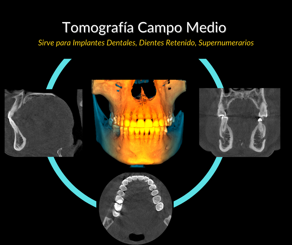2.Medio.