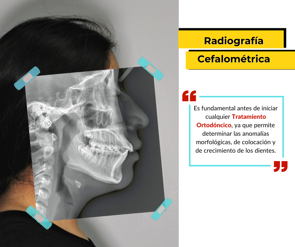 4.rx Cef