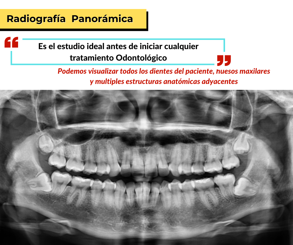 5.Rx pano