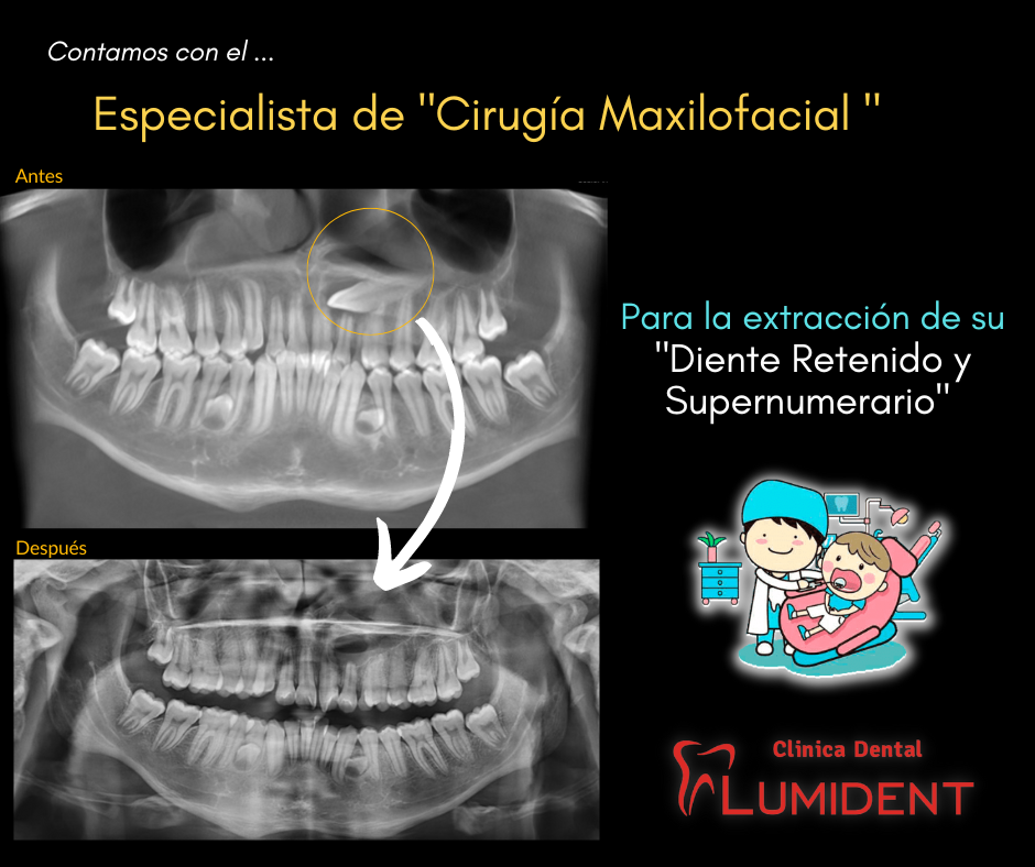 Cirugia Maxilofacial