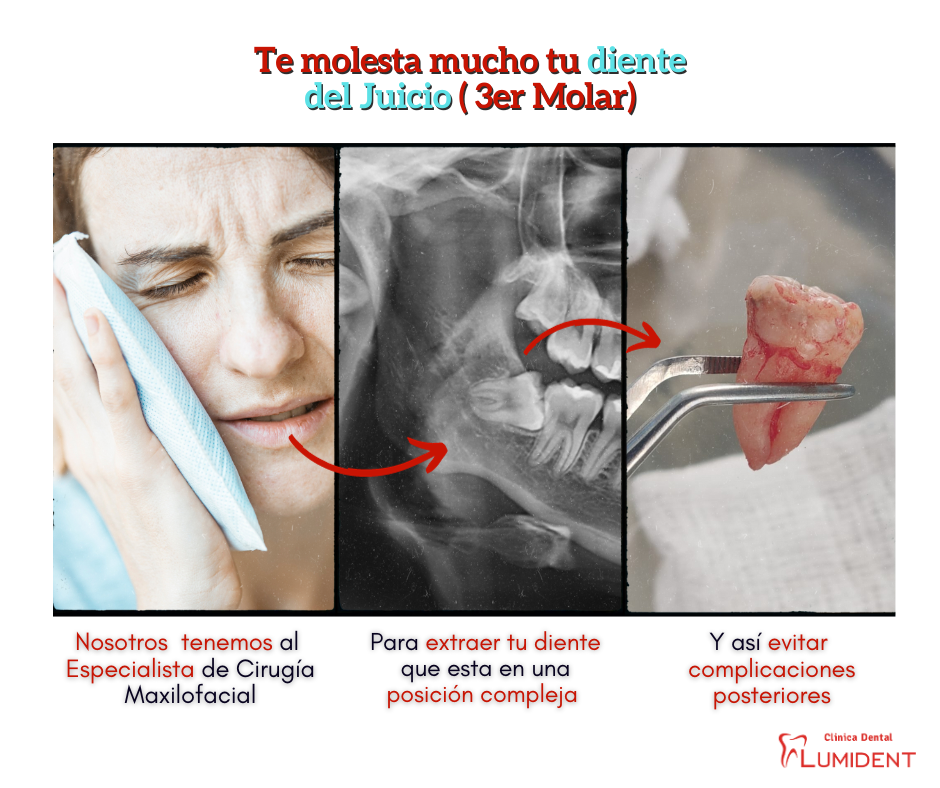 Extraccion diente del Juicio..